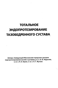 Тотальное эндопротезирование тазобедренного сустава